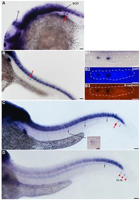 Insm1a Is Required for Zebrafish Posterior Lateral Line Development